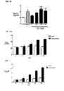 Fig. 04 - Pulmonary hypertension
