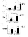Fig. 07 - Pulmonary hypertension