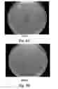 Fig. 08 - Compositions, devices, and methods for treating infections
