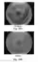 Fig. 09 - Compositions, devices, and methods for treating infections