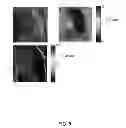 Fig. 06 - Compositions and Methods for Delivery of High-Affinity Oxygen Binding Agents to Tumors