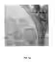 Fig. 07 - Compositions and Methods for Delivery of High-Affinity Oxygen Binding Agents to Tumors