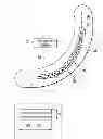 Fig. 01 - Forming Composite Features Using Steered Discontinuous Fiber Pre-Preg