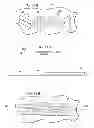 Fig. 16 - Forming Composite Features Using Steered Discontinuous Fiber Pre-Preg
