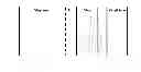 Fig. 02 - MULTI-LAYERED SHRINK FILMS