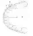 Fig. 02 - ORTHODONTIC APPLIANCE