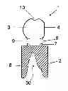 Fig. 01 - IMPRESSION DEVICE AND METHOD FOR THREE-DIMENSIONAL ACQUISITION OF INTRAORAL STRUCTURES, AND CORRESPONDING SCANNING DEVICE