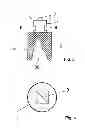 Fig. 03 - IMPRESSION DEVICE AND METHOD FOR THREE-DIMENSIONAL ACQUISITION OF INTRAORAL STRUCTURES, AND CORRESPONDING SCANNING DEVICE