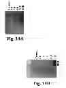 Fig. 15 - Granzyme A and granzyme B diagnostics