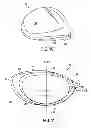 Fig. 09 - Golf club head