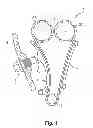 Fig. 02 - Method for producing a tensioning or guide rail with a vibration absorber