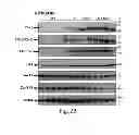 Fig. 06 - METHOD FOR ASSESSING A LIVER OF A PATIENT HAVING A CHRONIC HEPATITIS B VIRUS INFECTION