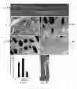 Fig. 12 - Dual-AAV vector-based systems and methods for delivering oversized genes to mammalian cells