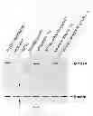 Fig. 19 - Dual-AAV vector-based systems and methods for delivering oversized genes to mammalian cells
