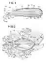 Fig. 02 - Brachytherapy devices and methods for therapeutic radiation procedures