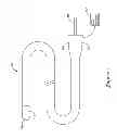 Fig. 02 - POWERED PULL WIRE DESIGN FOR ABLATION CATHETERS