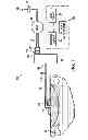 Fig. 02 - Negative pressure assisted tissue treatment system