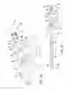 Fig. 06 - Bone graft delivery apparatus