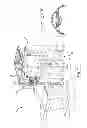 Fig. 02 - Systems and methods for removing fixation light reflection from an ophthalmic image