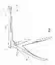 Fig. 02 - Surgical tool for LSS decompression