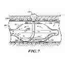 Fig. 08 - Apparatus for injuring nerve tissue