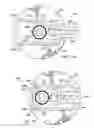 Fig. 07 - Systems and processes for inserting an intraocular lens