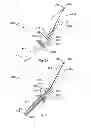 Fig. 07 - UTERINE MANIPULATOR