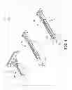 Fig. 07 - Apparatus and methods facilitating the repositioning of implanted medical devices
