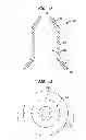 Fig. 02 - PMVR clip configurations for mitral leaflet