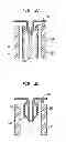Fig. 07 - PMVR clip configurations for mitral leaflet