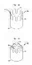 Fig. 08 - PMVR clip configurations for mitral leaflet