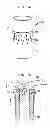 Fig. 09 - PMVR clip configurations for mitral leaflet