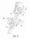 Fig. 07 - Device and method for through the scope endoscopic hemostatic clipping
