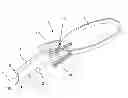 Fig. 01 - Surgical suture apparatus