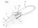 Fig. 02 - Surgical suture apparatus