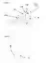 Fig. 06 - Surgical suture apparatus