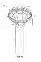 Fig. 03 - VESSEL OCCLUDING MATERIAL EXTRACTOR