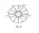 Fig. 04 - VESSEL OCCLUDING MATERIAL EXTRACTOR