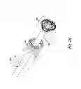 Fig. 06 - VESSEL OCCLUDING MATERIAL EXTRACTOR