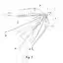Fig. 02 - Embolus blood clot filter delivery system