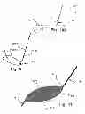 Fig. 08 - Temporary embolic protection device and medical procedure for delivery thereof