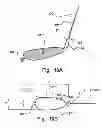 Fig. 09 - Temporary embolic protection device and medical procedure for delivery thereof