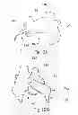 Fig. 10 - Temporary embolic protection device and medical procedure for delivery thereof