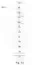 Fig. 11 - Temporary embolic protection device and medical procedure for delivery thereof
