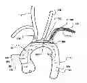 Fig. 01 - Temporary embolic protection device and medical procedure for delivery thereof