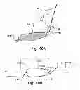 Fig. 09 - Temporary embolic protection device and medical procedure for delivery thereof