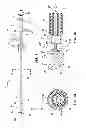 Fig. 02 - Active securement detachable sealing tip for extra-vascular closure device and methods