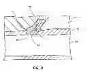 Fig. 09 - Active securement detachable sealing tip for extra-vascular closure device and methods
