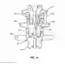 Fig. 08 - METHODS FOR CORRECTING SPINAL DEFORMITIES