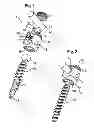 Fig. 02 - Bone anchor with plug member and tool for inserting the plug member into the bone anchor